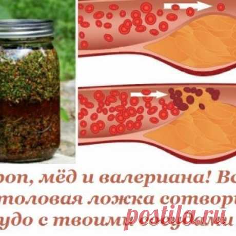 Укроп, мёд и валериана.... - МирТесен
