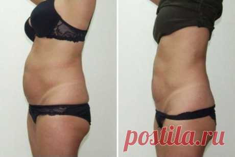 Копеечное аптечное средство для обертывания и пара упражнений - помогли мне убрать жир с живота за 10 процедур! | Худеем Дома | Яндекс Дзен