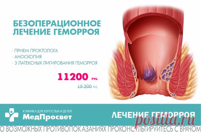 👉 Комплекс по проктологии "Безоперационное лечение геморроя" (м. Просвещения) со скидкой -25%

- Консультация проктолога;
- Аноскопия (диагностика прямой кишки);
- 3 лигирования латексными кольцами (3 процедуры).

Стоимость 11 200 руб. (вместо 15 200 руб.)

Записаться можно по телефону ☎ 8 (812) 374-84-00 или оставив заявку на сайте https://www.medprosvet.spb.ru/service/ligirovanie-latek

🏥 Адрес: м. Проспект Просвещения, пр. Энгельса д. 147, корп. 1