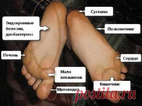 О чем говорят мозоли и как с ними бороться?
Удалять мозоли лучше в косметологическом кабинете, а вот размягчить грубую кожу можно и в домашних условиях. Для этого пользуются горячими ножными ваннами: на 1 литр воды положить 1 ч.л. пищевой соды. После ванны сделать маску для ноги из 6 таблеток аспирина, растертых в порошок, 1 ч. л. воды 6 растертых 1 ч.л. лимонного сока Процедуру повторять в течение 2 недель через день.
Профилактика мозолейКак только предоставляется такая возможность, разувайтесь