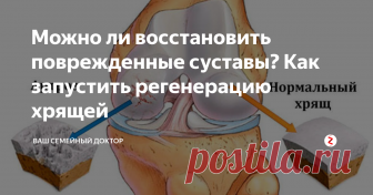 Можно ли восстановить поврежденные суставы? Как запустить регенерацию хрящей Повреждение хрящевой ткани - процесс, который рано или поздно встречается у каждого человека. С возрастом к нему приводят дегенеративные процессы, у молодых повреждение суставов часто связано с травмами или обменными нарушениями.
