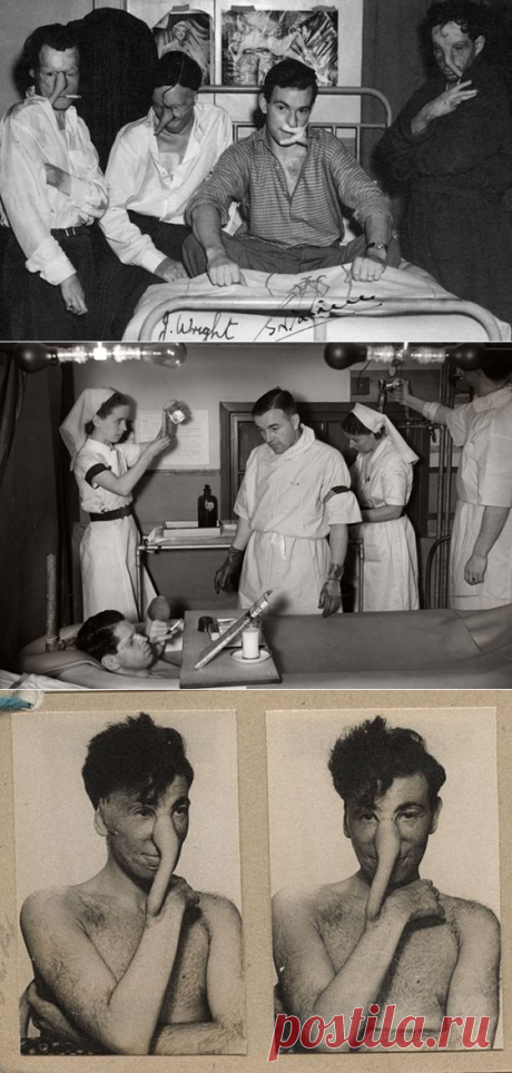 Как британский хирург и веселые медсестры возвращали изувеченных пилотов к жизни: Военно-полевая пластическая хирургия.