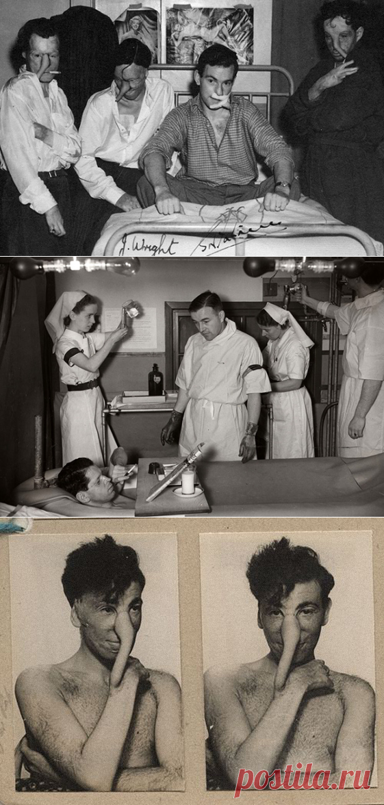 Как британский хирург и веселые медсестры возвращали изувеченных пилотов к жизни: Военно-полевая пластическая хирургия.