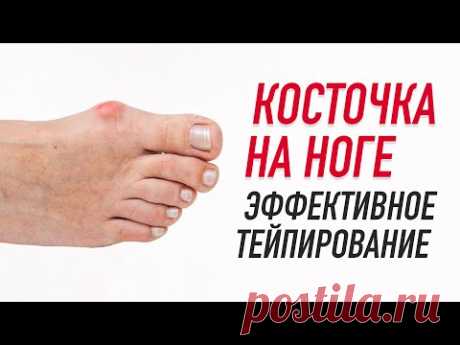 ✅ КОСТОЧКА НА НОГЕ. ЭФФЕКТИВНОЕ ТЕЙПИРОВАНИЕ | Валентин Гайт | Учебный центр BBALANCE