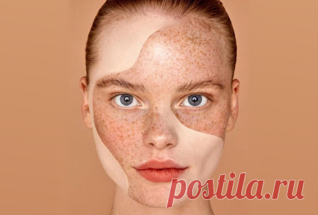 Пигментация на лице: причины и способы избавления