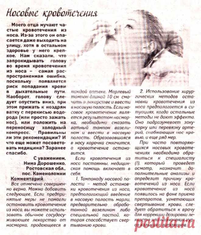 Носовые кровотечения