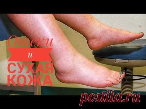 Эти две аптечные мази вместе работают лучше!