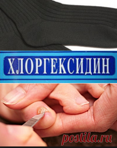 Как правильно обрабатывать обувь, носки и постельное белье при грибке? | Грибковые заболевания