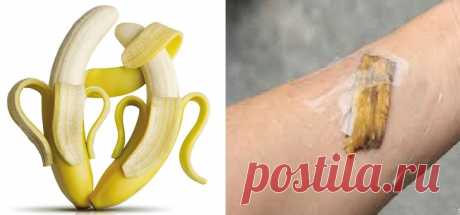 Bucce di banana: non buttatele! Ecco cosa possono fare - Meteofan