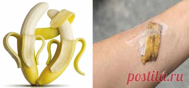 Bucce di banana: non buttatele! Ecco cosa possono fare - Meteofan