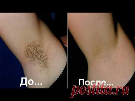Быстро избавиться от волос в области подмышек/3 потрясающих рецепта