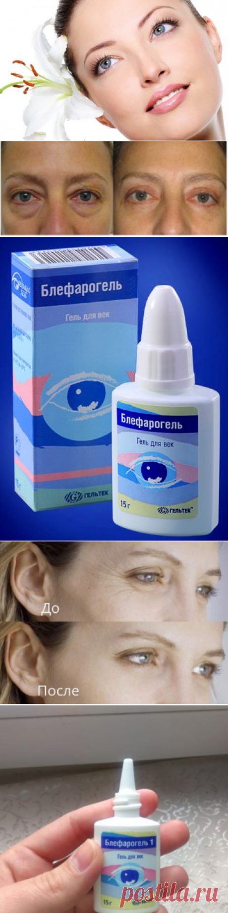 Блефарогель 1: гиалуроновая кислота от мешков под глазами, цена