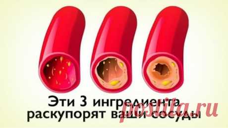 КАК ОЧИСТИТЬ СОСУДЫ С ПОМОЩЬЮ 3-Х ПРОДУКТОВ?