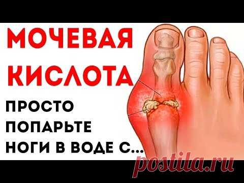 МОЧЕВАЯ КИСЛОТА нормализуется, а ПОДАГРА уменьшится, если выпить стакан отвара из обычной...