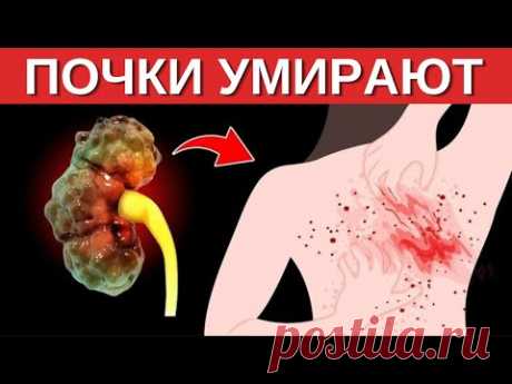 ПРИЗНАКИ ТОГО, ЧТО ВАШИ ПОЧКИ УМИРАЮТ!