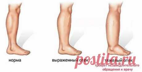 Боль в ногах? 10 простых решений! — Копилочка полезных советов