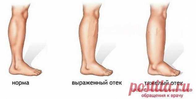 Боль в ногах? 10 простых решений! — Копилочка полезных советов
