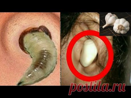 Многие не знают ! Это то, что происходит, если вы потребляете чеснок каждый день | польза чеснока