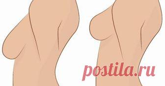 Эти шесть упражнений естественно укрепят вашу грудь без пластической хирургии!  


Это нормальная часть процесса старения женщин: грудь обвисает и большинство людей думает, что единственный вариант – пройти через операцию, но это не тот случай! Эти шесть простых шагов йоги помог…