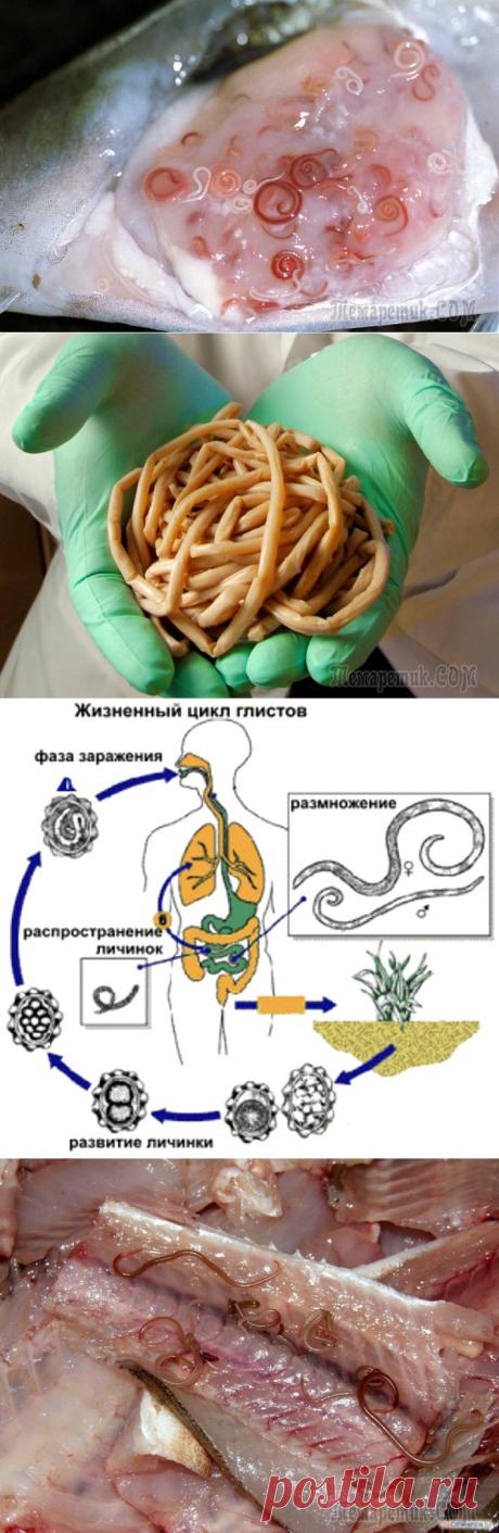 Гельминтоз – симптомы, лечение и профилактика