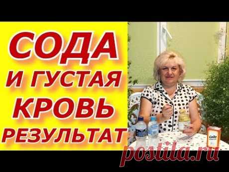 Сода - густая кровь !Метод И. П. Неумывакин . мой результат.