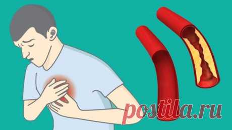 Їж їх більше – живи довше! Ці продукти прочистять артерії і захистять від серцевого нападу — Отож-то ж. Ну, що ж, підемо? — Підемо. — Ти тільки не пий, а то як би вони на нас не почали кидатися. — Не буду. — А я так навіть поїм. Я вже давно їх не їв. Поки доїмо, з'їмо – вони вже здохнуть. А то я б їх з'їв. І я підійшов до тіла, яке було вже розтрощено. Він був схожий на тіло, що вівся на останніх квітках. — Що ти купуєш? — Сірників. — Купуй! — Щоб вогонь горіли. — Давай! Ми кинули по сірнику і…