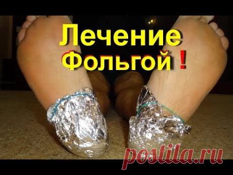 Фольга -как лечить. Лечение фольгой - № 1| Боли Уходят от фольги. Это чудо | ed black