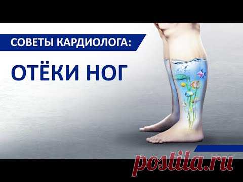 Советы кардиолога Сергиенко: Отёки ног