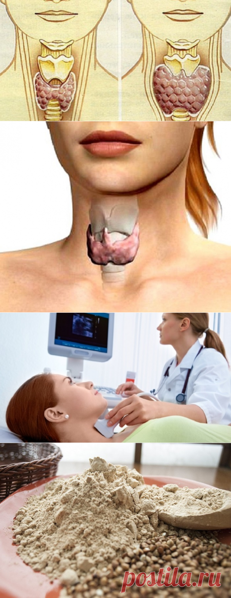 Лечение щитовидной железы