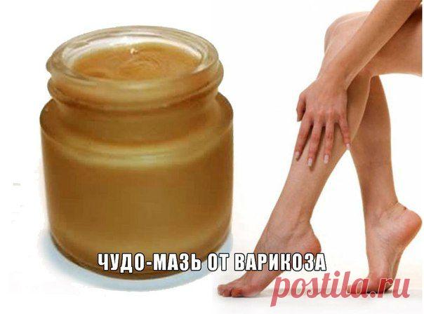 ♥ღ♥ЧУДО - МАЗЬ ОТ ВАРИКОЗА!♥ღ♥