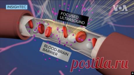 17-летняя украинка-эмигрантка придумала ДНК-робота для лечения болезней Паркинсона и Альцгеймера