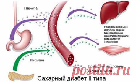 Как похудеть при диабете 2 типа: диета и физическая нагрузка