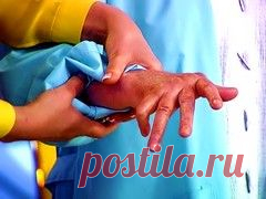Подагра (наросты на костях) - лечение народными средствами косточек на ногах