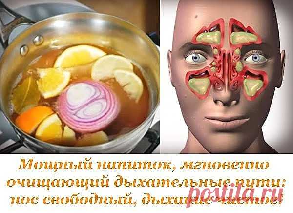 (73) Одноклассники