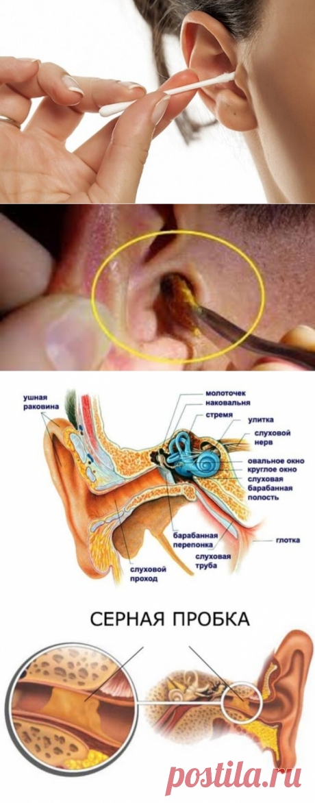 ПРИЧИНЫ ОБРАЗОВАНИЯ ПРОБКИ В УШАХ И БЕЗОПАСНОЕ ЕЁ УДАЛЕНИЕ | ЗАПИСКИ ФЕЛЬДШЕРА | Дзен