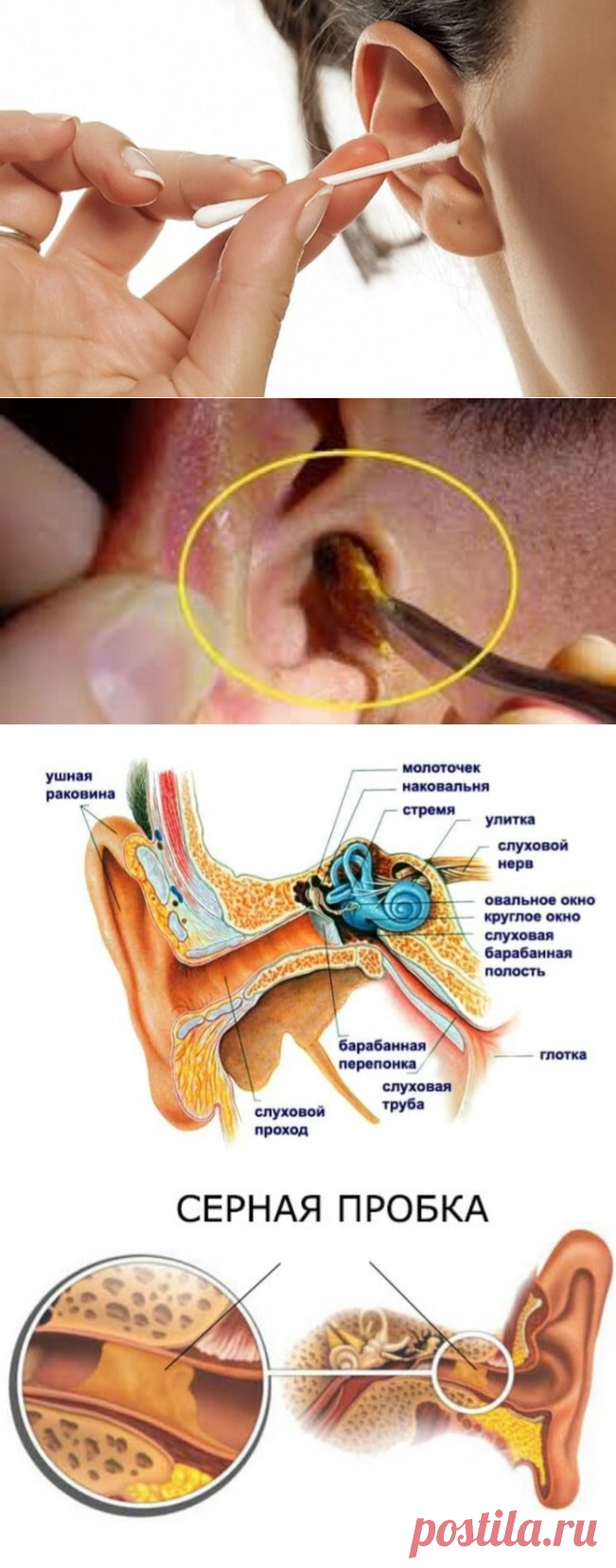 ПРИЧИНЫ ОБРАЗОВАНИЯ ПРОБКИ В УШАХ И БЕЗОПАСНОЕ ЕЁ УДАЛЕНИЕ | ЗАПИСКИ ФЕЛЬДШЕРА | Дзен