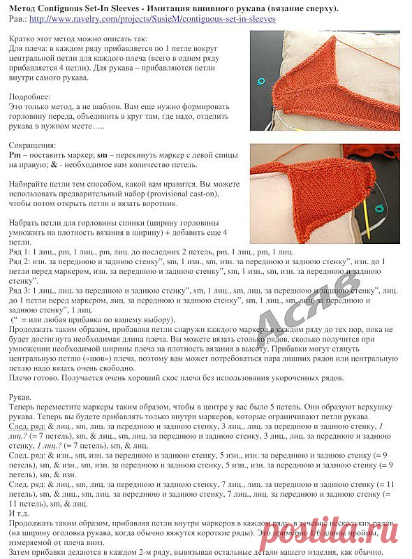 Метод Contiguous Set-In Sleeves (иммитация вшивного ракава).