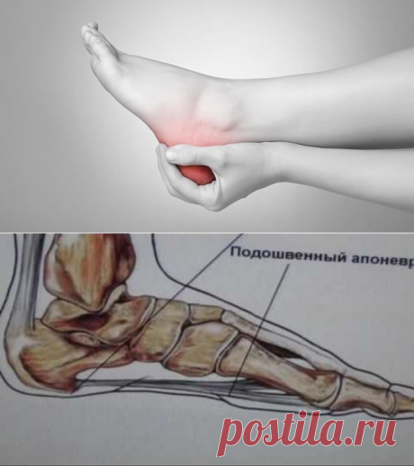 ШПОРУ ВЫЛЕЧИЛА ЗА 3 ДНЯ