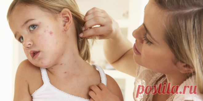 Дерматит — в поисках причин возникновения и эффективного лечение