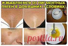 Секреты красоты и здоровья.: ИЗБАВЛЯЕМСЯ ОТ ПИГМЕНТНЫХ ПЯТЕН В ДОМАШНИХ УСЛОВИЯХ!