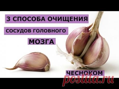 3 способа очищения сосудов головного мозга чесноком.Лечение нервной системы,укрепляет иммунитет.