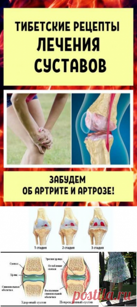 Артроз нижних конечностей. Лечение без хирургического вмешательства.
Чаще всего артроз развивается в области основного (плюснефалангового) сустава большого пальца стопы. 
Пяточная шпора не дает покоя
«Гвоздь» в подошве. Чем опасна пяточная шпора и как от нее избавиться.
Диета при варикозе
Страшная болезнь - остеопороз
Как сохранить кости здоровыми на долгие годы? 
идеи для фартуков

вязаные панамки
рецепты с сельдереем
Остеохондроз с каждым годом молодеет

Ревматоидный артрит