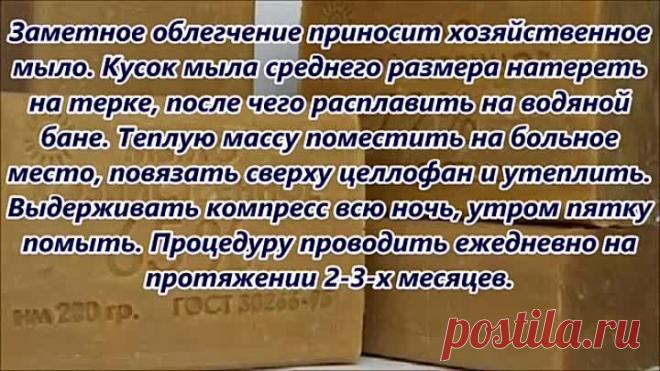 Несколько народных рецептов от пяточной шпоры