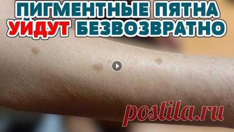 КАК УБРАТЬ ПИГМЕНТНЫЕ ПЯТНА, ШРАМЫ от АКНЕ, ВЕСНУШКИ на лице! Мазь от ПИГМЕНТАЦИИ, рецепт! КАК УБРАТЬ ПИГМЕНТНЫЕ ПЯТНА, ШРАМЫ от АКНЕ, ВЕСНУШКИ на лице! Мазь от ПИГМЕНТАЦИИ, рецепт! #пигментныепятна #маскадлялица #пятнаналице #пигментныепятн...