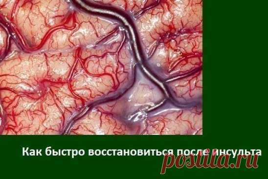 Значит так… Как мы восстанавливались после инсульта мозга.
1. Во-первых — аспирин. Кроверазжижающее. Каждый день. По 1 таблетке, размолотый в порошок. Смешать с сахаром и принимать.
И статины. Но…только, если печень здоровая. Абсолютно здоровая. Очень плохие побочные эффекты…У нас — Симвастатин.
2. С утра натощак — если очень высокое давление — 2 СТОЛОВЫХ ложки кунжутного масла смешать с 1 ст.ложкой меда. съесть. Прилечь минут на 20. Сбивает давление сильно, но мягко. Я да...