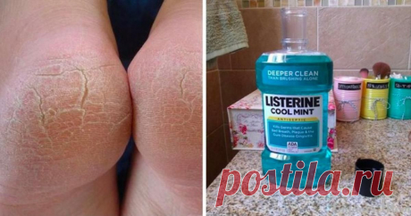 Удивительные способы использование Listerine, о которых должна знать каждая женщина Гигиена полости рта — дело важное, поэтому для нее придумали множество полезных средств. Состав ополаскивателя для рта разрабатывали тщательно и совершенствовали много лет. Поэтому сегодня у этого сре…