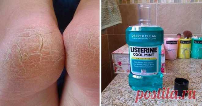 Удивительные способы использование Listerine, о которых должна знать каждая женщина Гигиена полости рта — дело важное, поэтому для нее придумали множество полезных средств. Состав ополаскивателя для рта разрабатывали тщательно и совершенствовали много лет. Поэтому сегодня у этого сре…