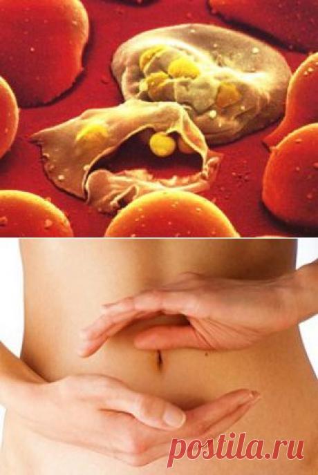 Паразитоз | Квинтэссенция Здоровья