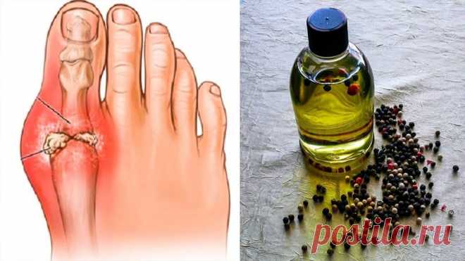 Как похудеть, вывести из суставов мочевую кислоту, снять воспаление и избавиться от тяги к курению с помощью этого масла Масло черного перца подарит вам легкость в суставах, избавит от желания курить, очистит организм от всего лишнего! Попробуйте!

Издавна черный перец использовался в качестве валюты, а сейчас мы добавл…