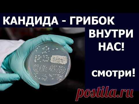 Грибки КАНДИДА ГРИБОК ВНУТРИ НАС. СИМПТОМЫ КАНДИДОЗА У МУЖЧИН И ЖЕНЩИН. Питание при кандидозе.